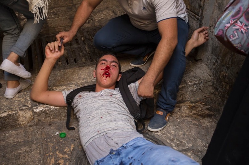 A Palestinian is carried after being wounded in clashes with Border Police officers in the Old City of Jerusalem, September 13, 2015. (photo: Faiz Abu-Rmeleh/Activestills.org)